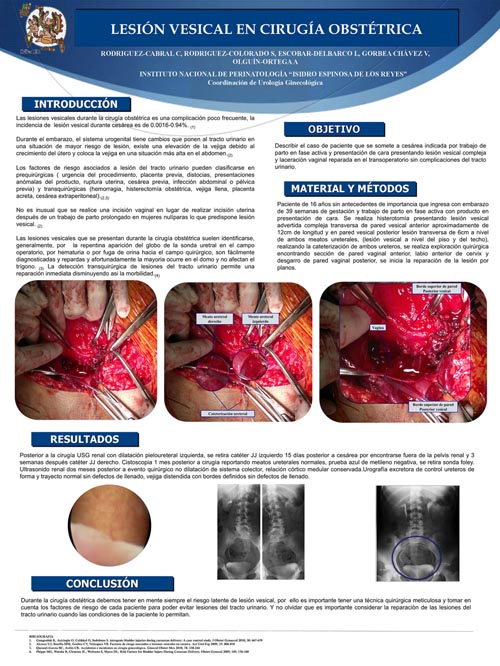 INVESTIGACION EMBARAZO GEMELAR investigacion embarazo gemelar: